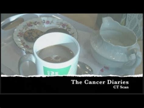 Cancer Diaries Vol 4 CT Scan YouTube