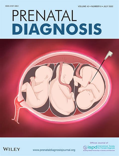 Iniencephaly Prenatal Diagnosis And Management Sahid 2000