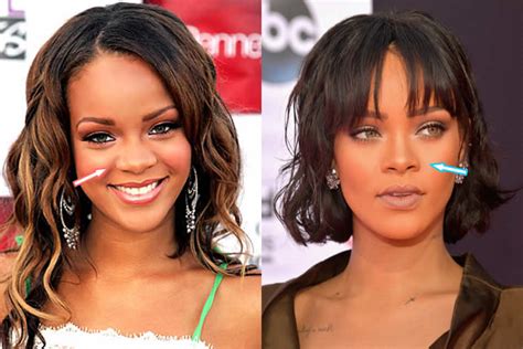 African American Plastic Surgery Before And After Celebrity Plastic