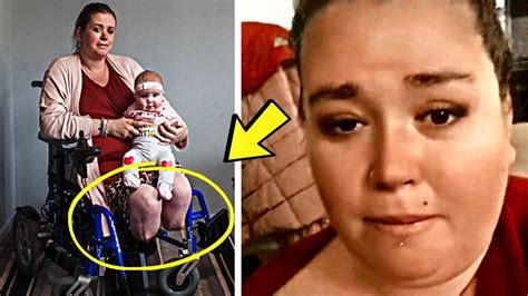 Mom Of 8 Wakes Up After C Section Horrified To See She No Longer Has Legs Youtube