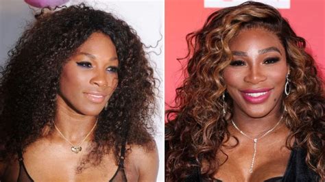 Serena Williams Before And After Plastic Surgery