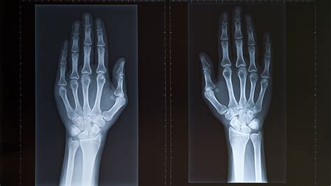 was ist röntgen und wann setzen Ärzte das verfahren ein focus arztsuche