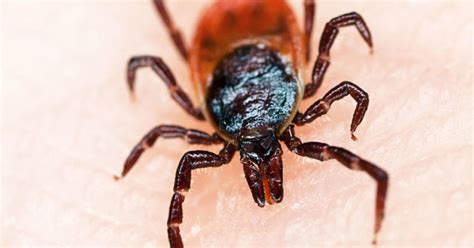 Lyme Disease Lies And Truths