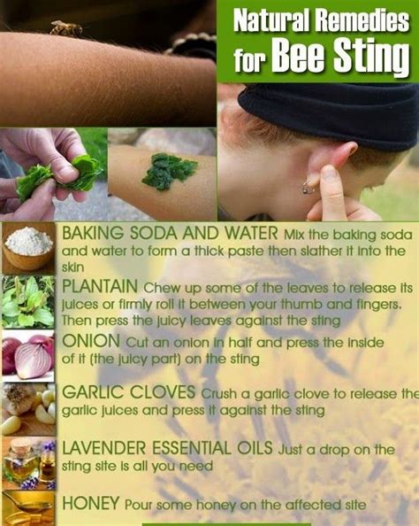 Home Remedies For Bug Bites Remedies For Bee Stings Remedies Bee