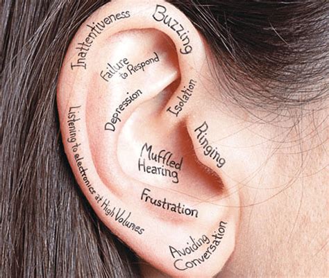 Types Of Hearing Loss Audiologist Happy Ears