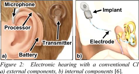 Figure 1 From Stimulating Auditory Nerve With Mems Harvesters For Fully Implantable And Self