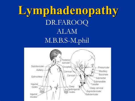 Lymphadenopathy In Children