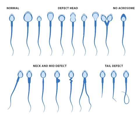 what is tested in a semen analysis and why bridge clinic