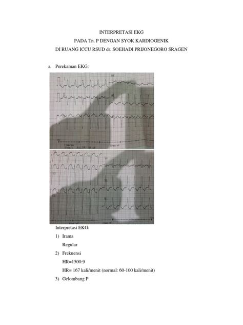 12 lead ecg interpretation mchenry western lake county ems system topics anatomy revisited the 12 lead ecg device the 12 lead ecg format waveform components lead views anatomy… Interpretasi Ekg