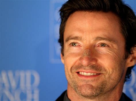 Hugh Jackman The Actor Urges People To Wear Sunscreen He Has Had