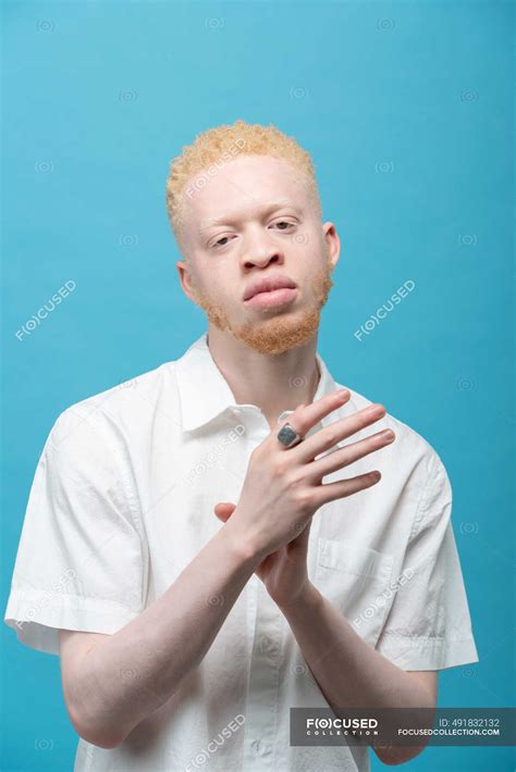 Studio Portrait Of Albino Man In White Shirt — Person Male Stock