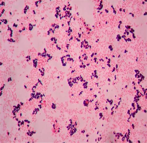 Gram Stain Laboratory Exercises In Microbiology