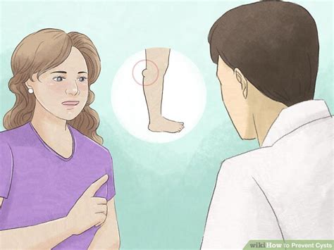 Ways To Prevent Cysts Wikihow Health
