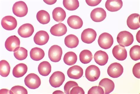 Morphologic Evaluation Of Red Blood Cells Medical Laboratories