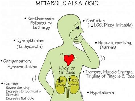 Metabolic Alkalosis Definition Causes Symptoms Diagnosis Treatment