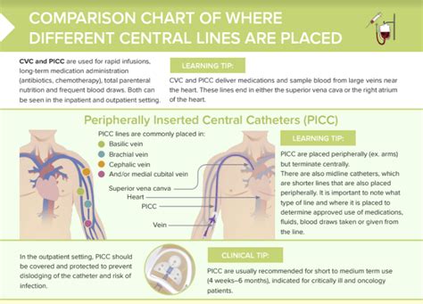 Why Use A Picc Line Over A Central Line Advantages And Considerations