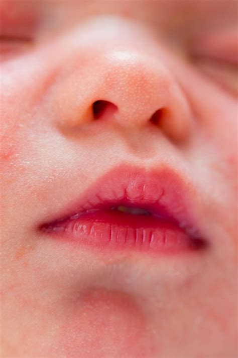 Little Red Spots On Toddlers Lips