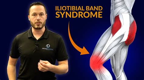 Knee Pain Relief Itb Syndrome Stretches Youtube