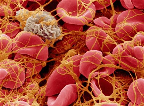 What Are Platelets And Why Do We Need Them We Are Blood