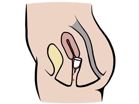 If you feel a little uncomfortable in any of the below situations, it could be an indicator that you have a tilted uterus. How to stop menstrual cup leaking | Pixie Cup