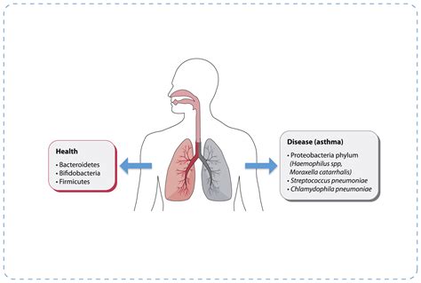 Microbiota And Asthma Clinical Implications Respiratory Medicine