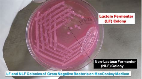 Lactose Fermenter Colony And Non Lactose Fermenter Colony Morphology Of