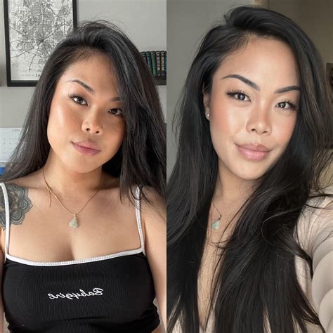 Masseter Botox before & after : r/PlasticSurgery