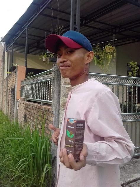 Di payudara saya sebelah kiri ada benjolan namun tidak sakit saat ini saya minum minyak habbatussauda, minyak zaitun, dan madu 1 sendok makan pagi dan. Varash Indonesia - Home | Facebook