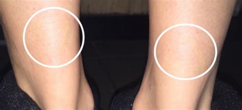 Uv tattoos and white ink tattoos are two separate animals. White Ink Tattoos — Liquid Amber Tattoo