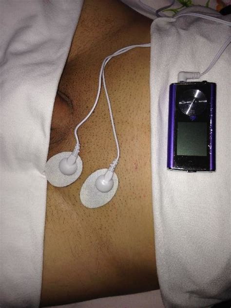 Tens Transcutaneous Electrical Nerve Stimulation Points Download
