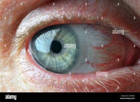 Blood Capillaries Hi Res Stock Photography And Images Alamy