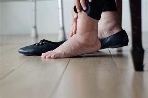 How To Treat Swollen Ankles 7 Best Treatment Options