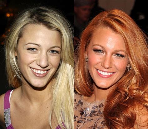 There are simple instructions to follow that greatly reduce your stress. How nosy! Celebs who may have had nose jobs - NY Daily News