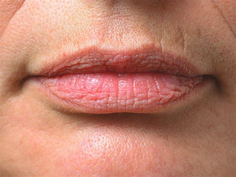 What Does It Mean When You Have Black Spots On Your Lips