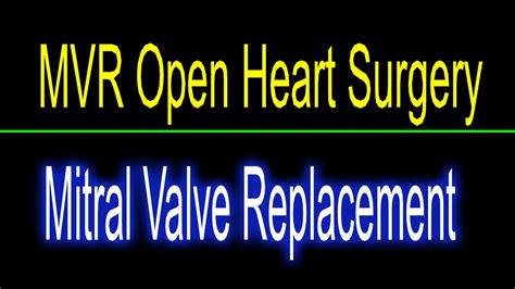 Mvr Mitral Valve Replacement Open Heart Surgery Youtube