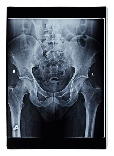 Top 60 Male Pelvis Stock Photos Pictures And Images Istock