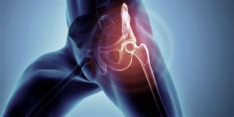 Hip And Groin Injury Physio Treatment Perth Sports Physio