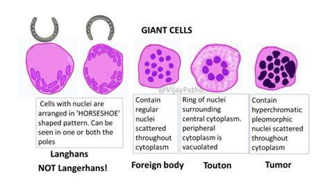 Types Of Giant Cells In Medicine