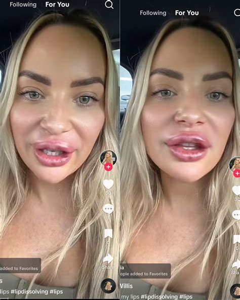 Mafs Melinda Willis Before And After Plastic Surgery