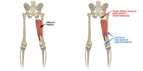 sit bone pain Archives - Yoganatomy