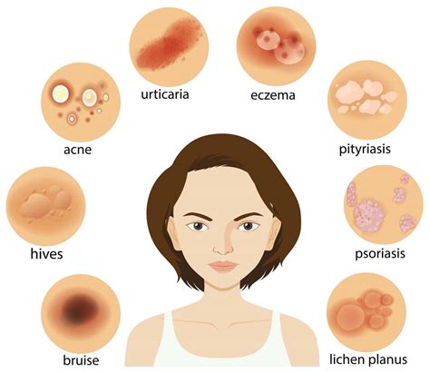 Diagram Showing Different Skin Conditions Swiss Point Of Care