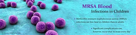 Less Fatal Mrsa Blood Infections In Children Could Develop Significant