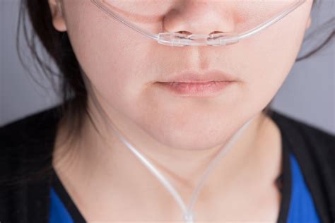 High Flow Nasal Cannula A Versatile Device Journal Of Anaesthesia