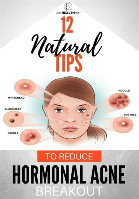 Natural Tips To Reduce Hormonal Acne Breakout Toned Hormonal
