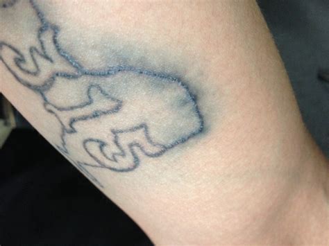 When tattoos are applied, the tattoo artist has to stretch the skin while inserting the needle so that the ink can be better applied. What Is Tattoo Blowout & Can You Fix It? | AuthorityTattoo
