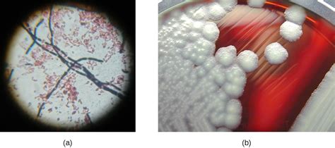 Gram Positive Bacteria Microbiology