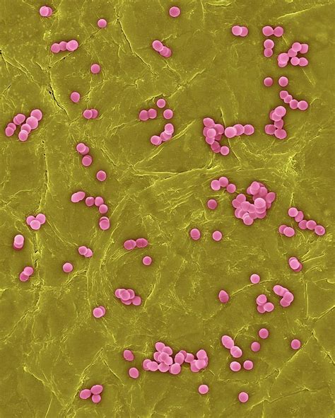 Enterococcus Faecium On Human Skin Photograph By Dennis Kunkel