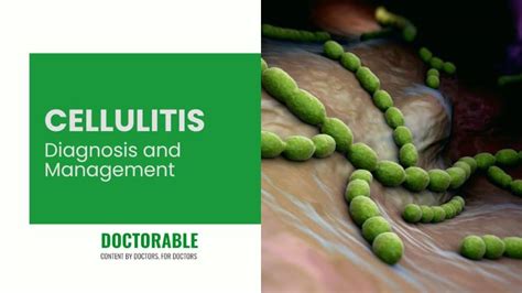 Cellulitis Diagnosis And Management Doctorable