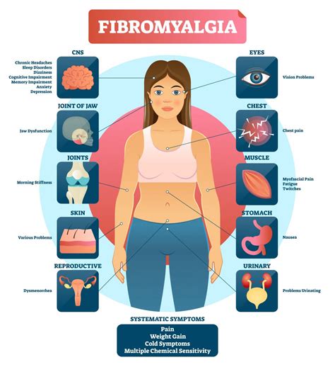 What Is Fibromyalgia Theramotion