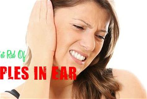 Use one of the many medicinal and natural remedies suggested by. How to Get Rid Of Pimples in Ear: Medicinal & Natural Tips ...
